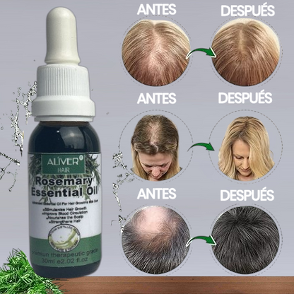 💚 Aceite Esencial Rosemary: El ‘Botox’ Capilar Natural que Reinicia tu Cabello 💚
